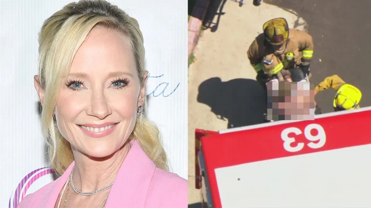 Anne Heche Suffering From Severe Burns After A Car Crash