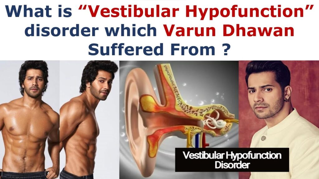 All About Vestibular Hypofunction, the Disease Varun Dhawan is Battling