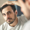 Best Hair Loss Treatments for Men in 2023