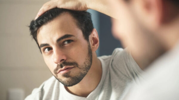 Best Hair Loss Treatments for Men in 2023